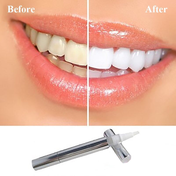 Flawless Teeth Whitening Pen - gocyberbiz.com